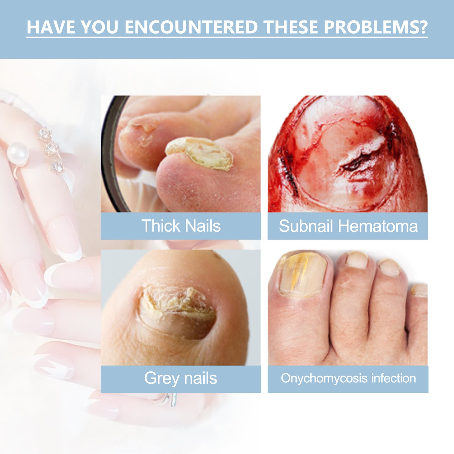 Hand And Foot Nail Nutrition Moisturizing Repair Soft Nail Gentle Cleaning Bright Nail Care