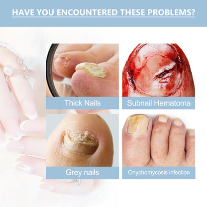 Hand And Foot Nail Nutrition Moisturizing Repair Soft Nail Gentle Cleaning Bright Nail Care