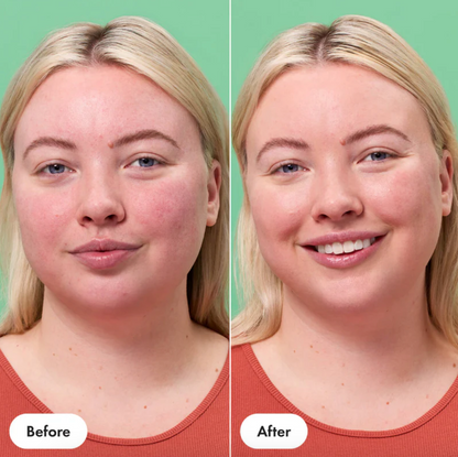 Rescue Balm™ +Red Correct