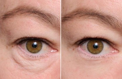 Firmessence™ Tightener Cream